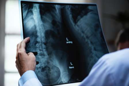 Lastra con radiografica torace